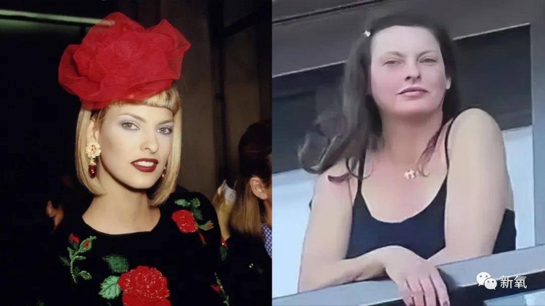 因为绝世美人因为冷冻溶脂毁容消失5年，轻医美没你想的那么轻！
