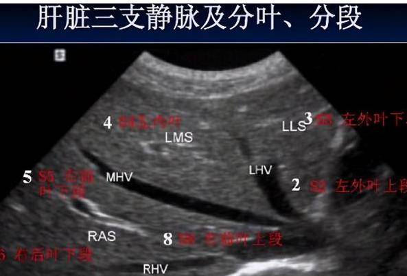 肝脏|检查肝脏，选B超好还是CT好？哪个结果更准？