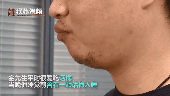 海姆|警惕！一男子含着话梅睡觉 话梅核卡进气道险丧命