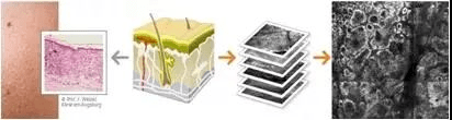 美容第四代皮肤CT，助力医学皮肤美容疗效的评估！