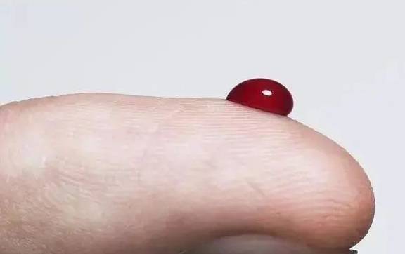 血液|血糖高的人，身体会出现3个异常，若一个没有，血糖控制得还不错