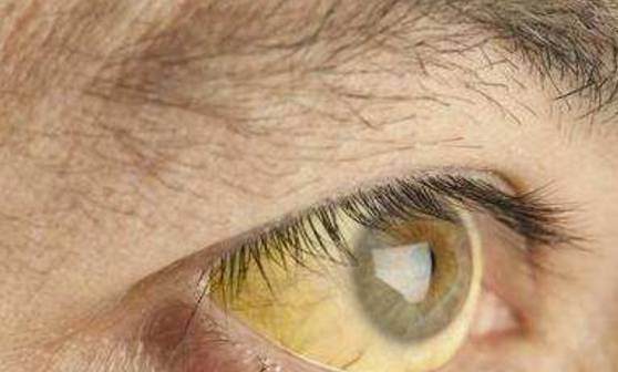 眼睛|肝病不痛不痒，若脸上发出这3个“信号”，你可能需要养肝了！