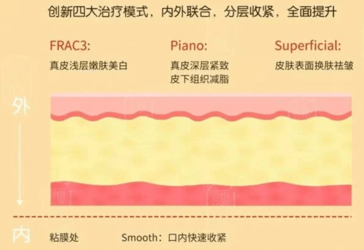 玛吉卡戴珊同款欧洲之星效果怎么样，为什么说欧洲之星效果不太行