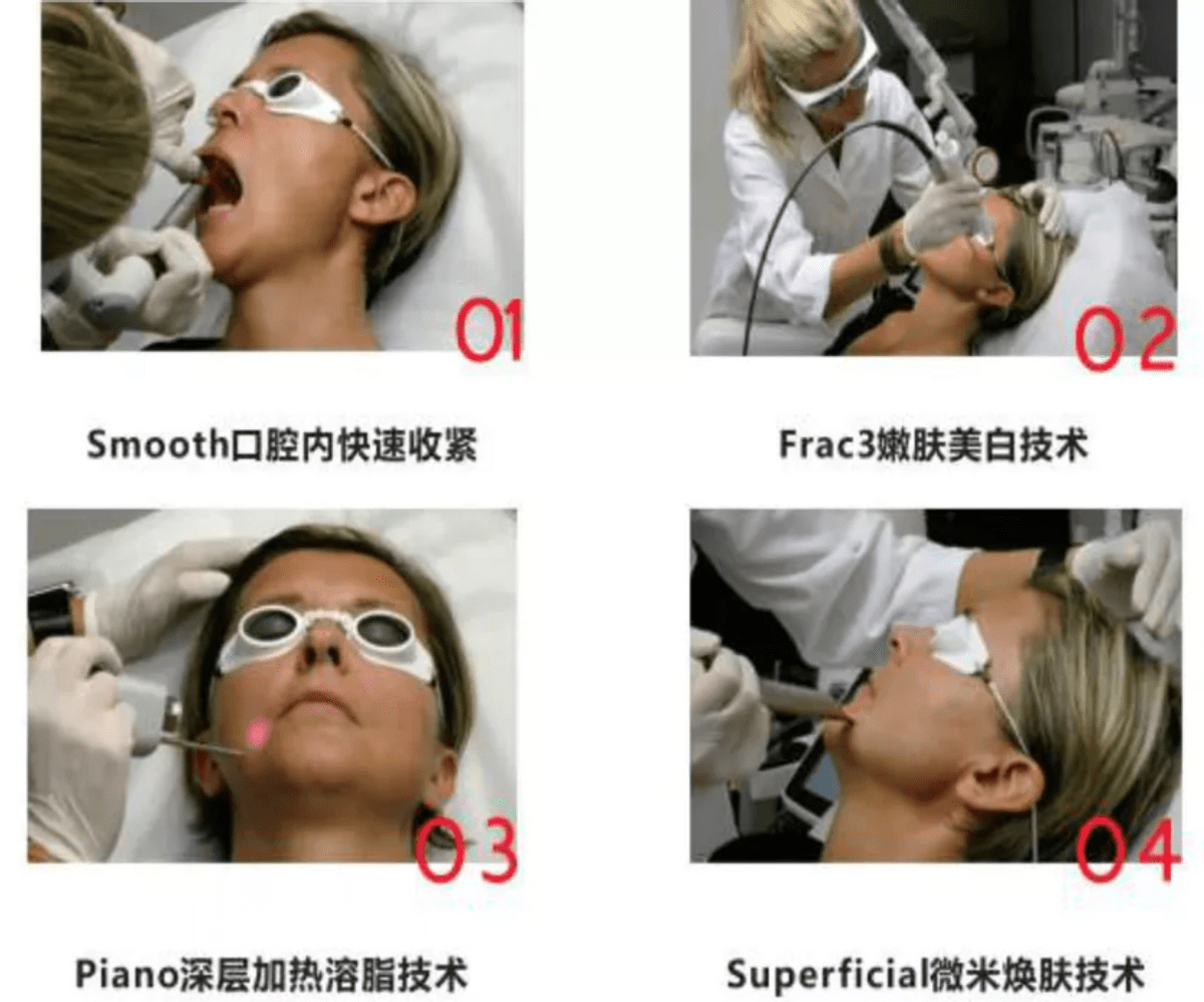 玛吉谈一谈，Fotona 4d和热玛吉区别，欧洲之星效果，到底怎么选