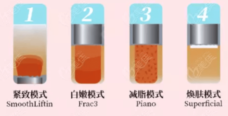 玛吉谈一谈，Fotona 4d和热玛吉区别，欧洲之星效果，到底怎么选