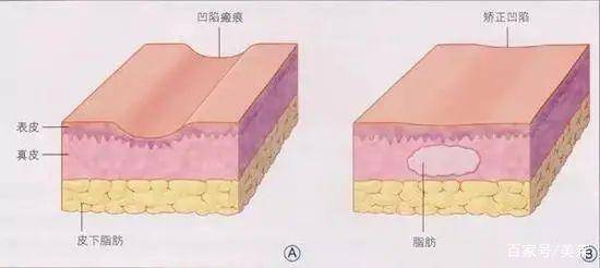 后天郑州美莱-原生骨相不给力，如何后天逆袭皮相美人？