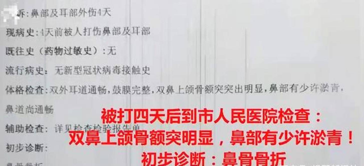 家长|3岁男孩鼻子被幼师打成轻微伤，曾危险驾驶被拘役，家长已起诉