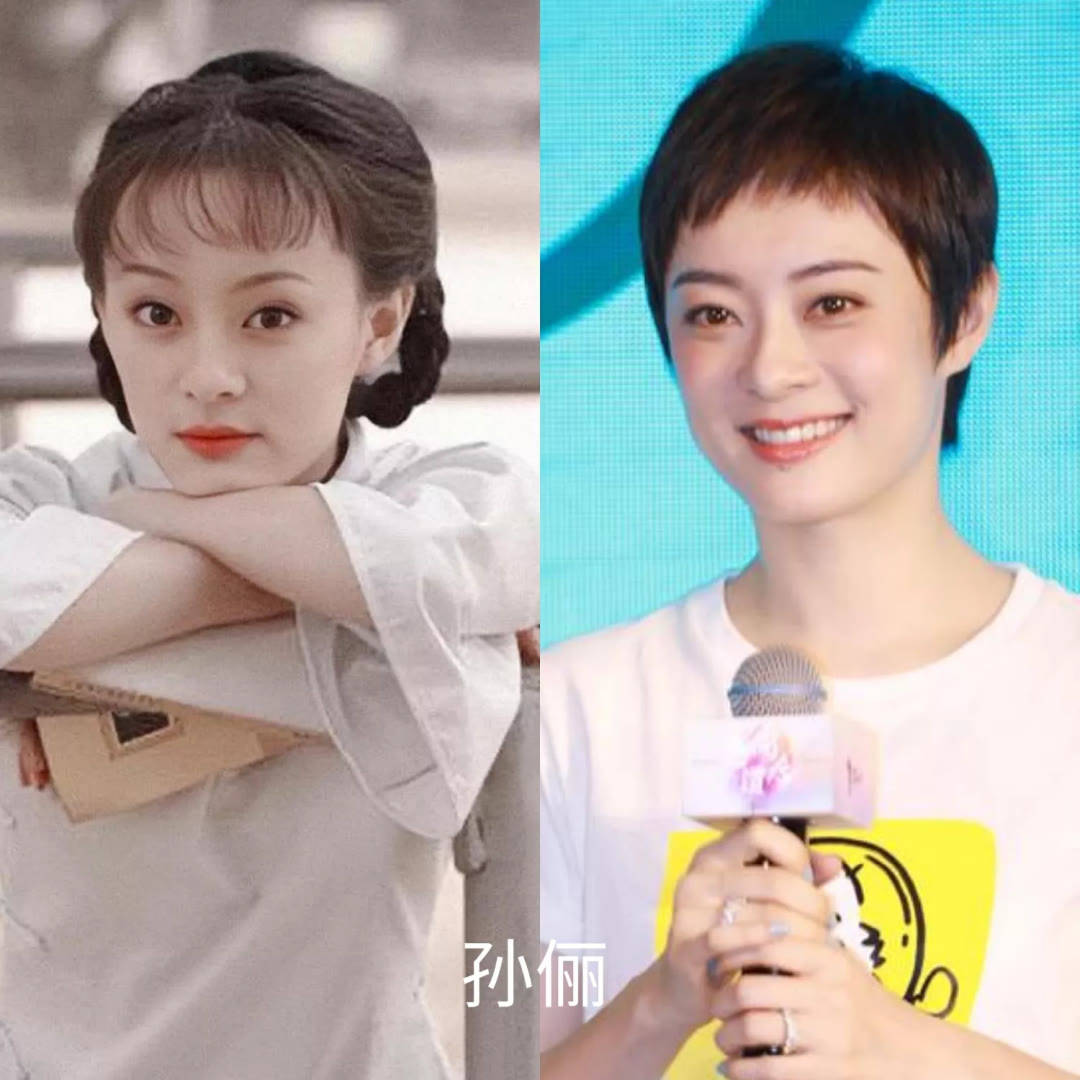 因为脸肿成猪头，神仙姐姐怎么变样儿了？