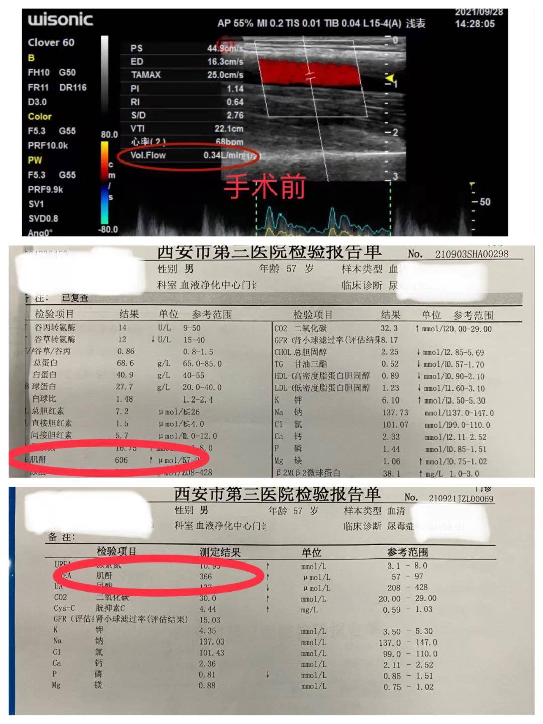 史井波|守瘘人｜“百密终无一疏”