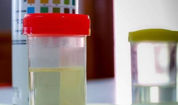 出现泡沫|身体出现4个“不同”，可能是尿毒症在“攻打”你