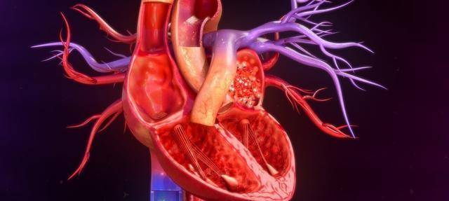 什么是动脉粥样硬化和血管瘤 648fd73c9cae44739873b3c96b013d21.jpeg