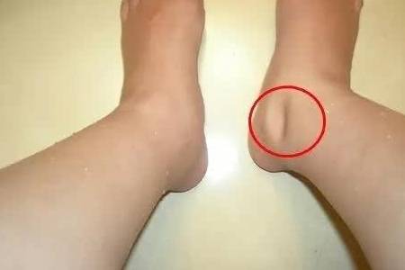 症状|提醒：40到55岁是“养命关键期”，请别忽视这3个器官的病变症状