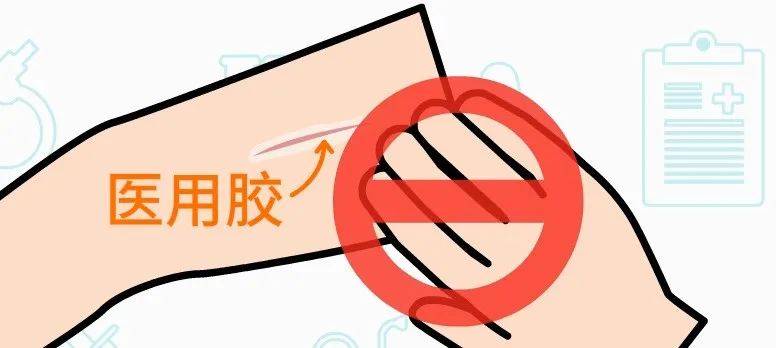 治疗|【科普动画】淋巴管静脉吻合术 术前术后要做啥？