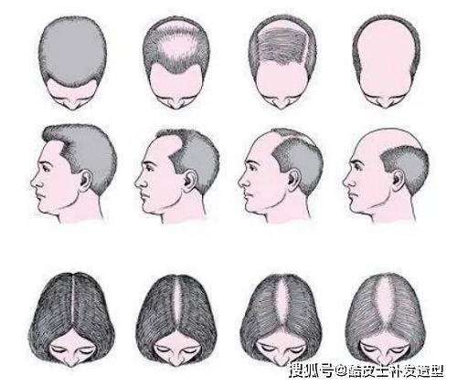 因为陈小春这个动作有深意，难怪能20年发际线不后移，学到了