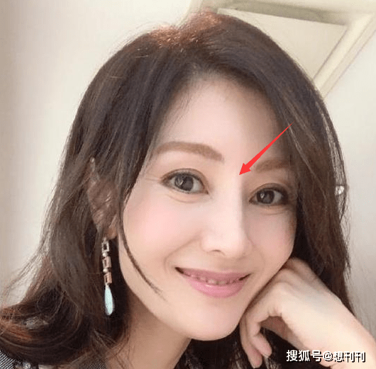 结局整容风刮到香港，这7位港圈大美人竟跑去DO脸上，结局一言难尽