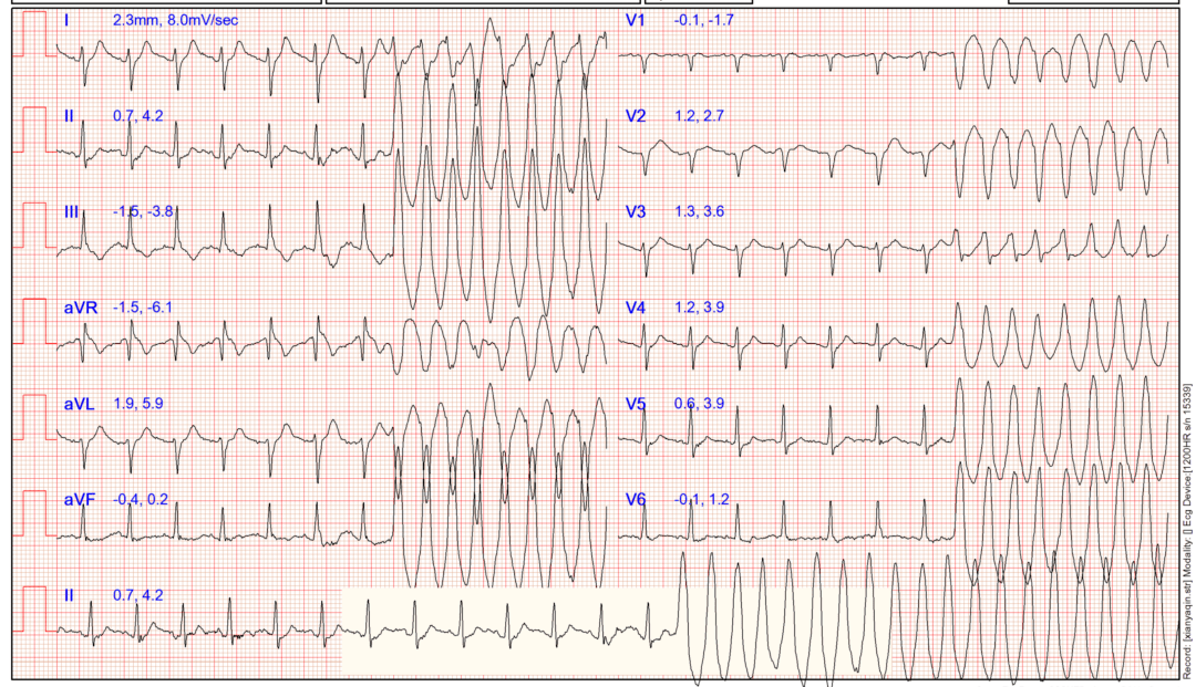 检查|装病？32岁女子一干活就晕倒！婆家人也不理解