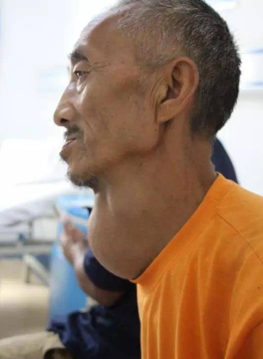 食管|张先慧主任分享:让甲状腺疾病治疗更高效,更精准!