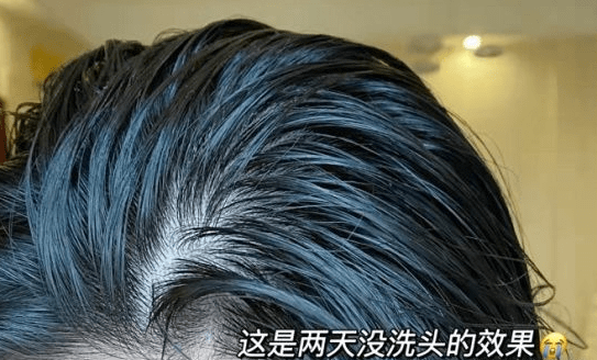 姐妹二胎辣妈养发秘诀！坚持“外养+内调”，轻松拥有鞠婧祎同款发量