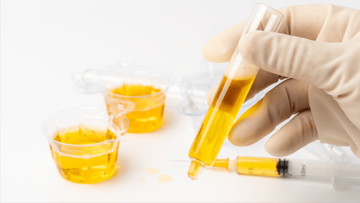 讯息|肝脏不好身体会有所体现， 注意“查收肝脏的讯息”，护肝常吃1物