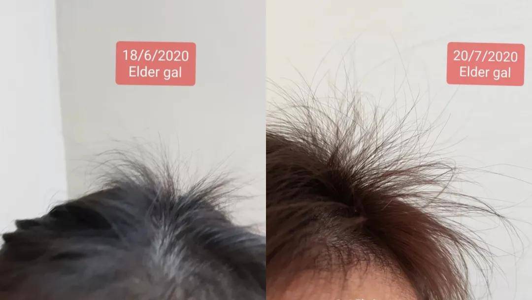 代谢|要是早知道这几招，最起码少掉几万根头发，心痛…