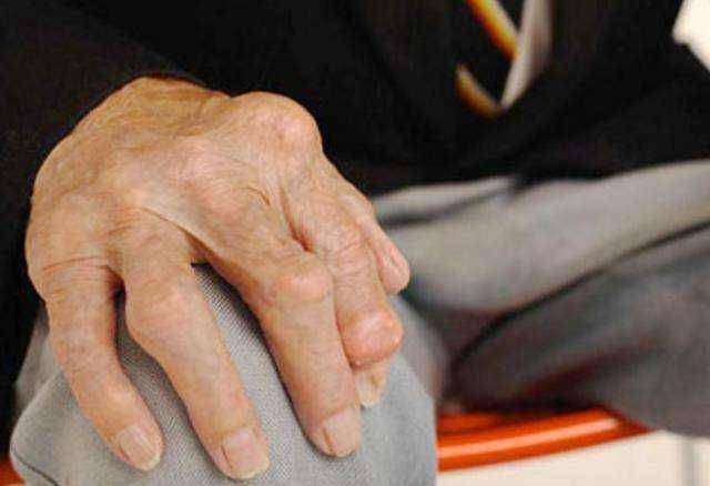 风湿骨痛想要缓解老病人日常必做3件事疼痛痹痛自然少