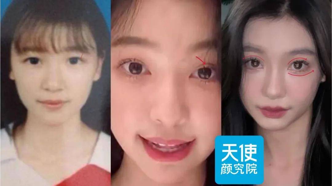 小天扒完易梦玲换头成小x书第一美女的过程…respect!