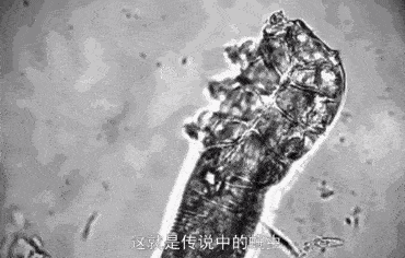 症状假如脸上这3个症状明显，那你面部可能有“螨虫”，需要尽早改善