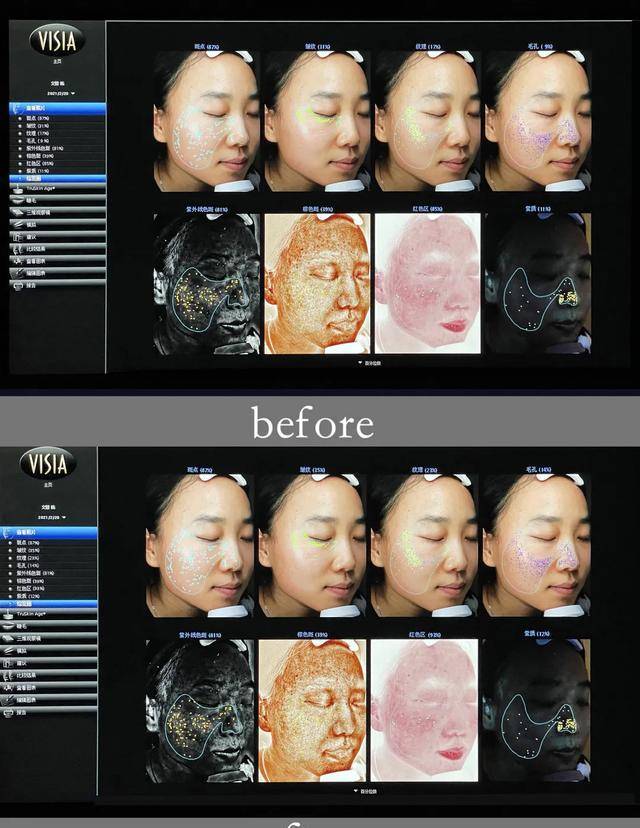 产品美肌‖他们要怎么做,才能让肤质显好不显老?