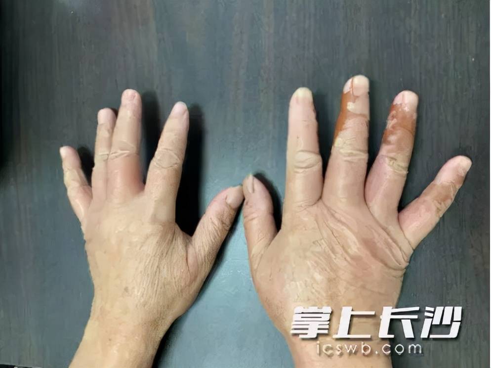 毒性|当心！路边常见的这东西有毒，千万别随意&amp;quot;碰&amp;quot;！严重可致命