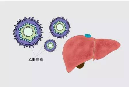 肝脏|医生提醒:乙肝最佳治疗时机看检查,已经耽误的请别犹豫