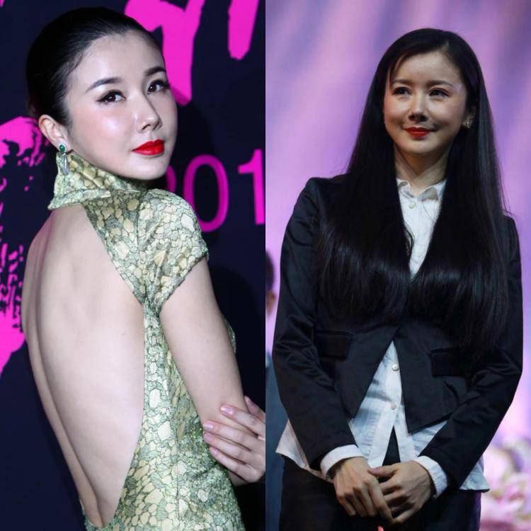 娄艺潇动脸的7位女星，一个比一个神奇，有人请医美专家鉴定自己纯天然