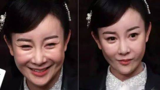 娄艺潇动脸的7位女星，一个比一个神奇，有人请医美专家鉴定自己纯天然