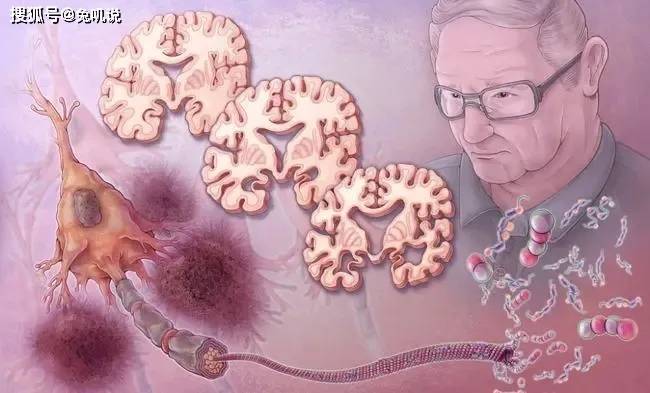 症状|【益脑补髓汤】多系统萎缩病中医最新治疗