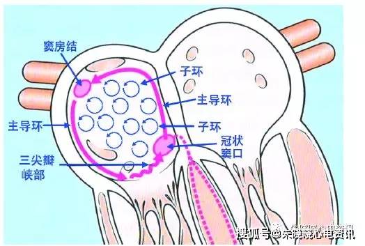 圖7 房撲為主導環折返絕大多數房撲大折返的環形激動從三尖瓣峽部出口