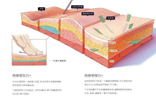 针美汇美肌密钥自然抗衰开启肌肤修复潜能