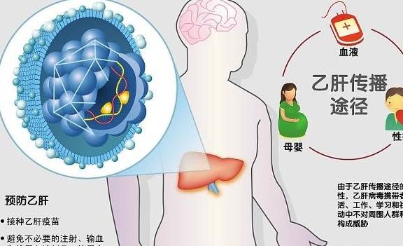 异常现象|患上“乙肝”后,这5件事尽量“少做”,身体或许会“感激”你!