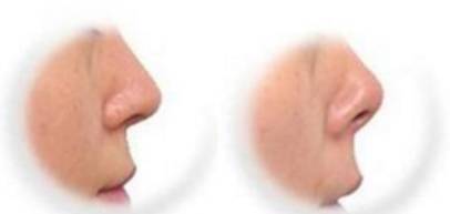 整形这是我见过最敢的女星,猪鼻子还能演美女?