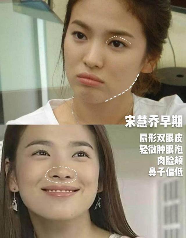 常平甜美系长相女生怎样正确抗老