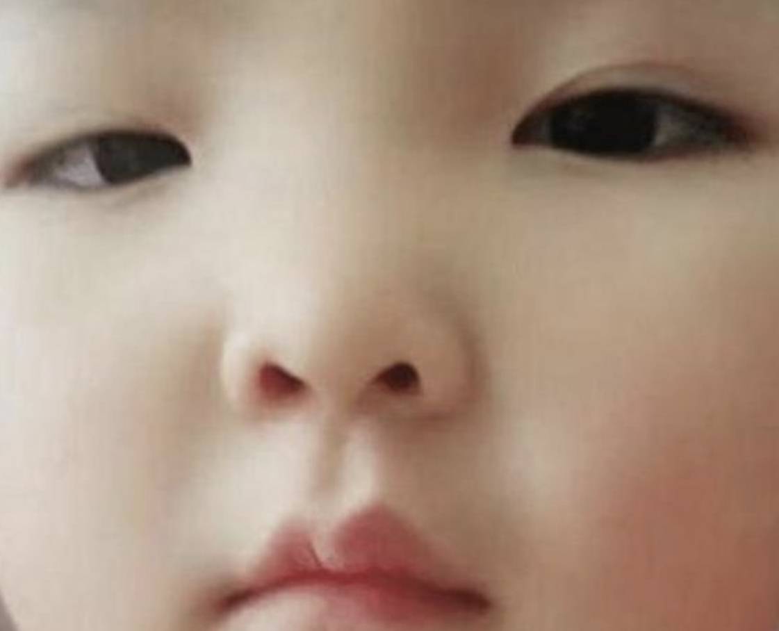 单眼皮为了让女儿变美，妈妈直播给女儿割双眼皮，网友：心疼孩子