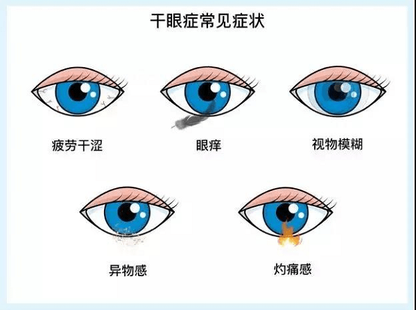 维修|心灵窗户维修剂，LLT NMN有效治疗干眼症