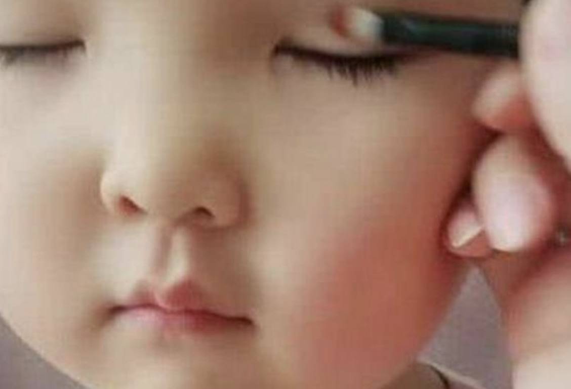 单眼皮为了让女儿变美，妈妈直播给女儿割双眼皮，网友：心疼孩子