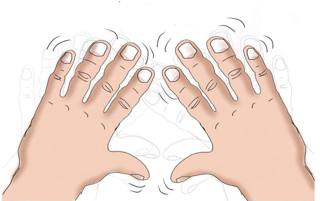 闵加亮手脚震颤10年是阴血不足还是虚风内动