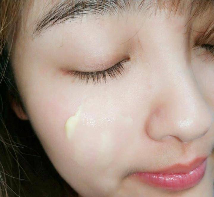 包文婧邓紫棋晒出一款祛斑乳膏，因价格便宜被忽视，用后斑斑点点消失了