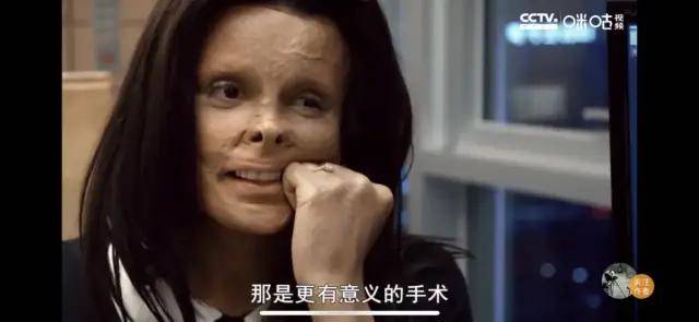 整形二美：整形，一个美丽的“陷阱”