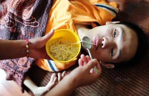 症状|运动神经元病给患者造成的危害有哪些