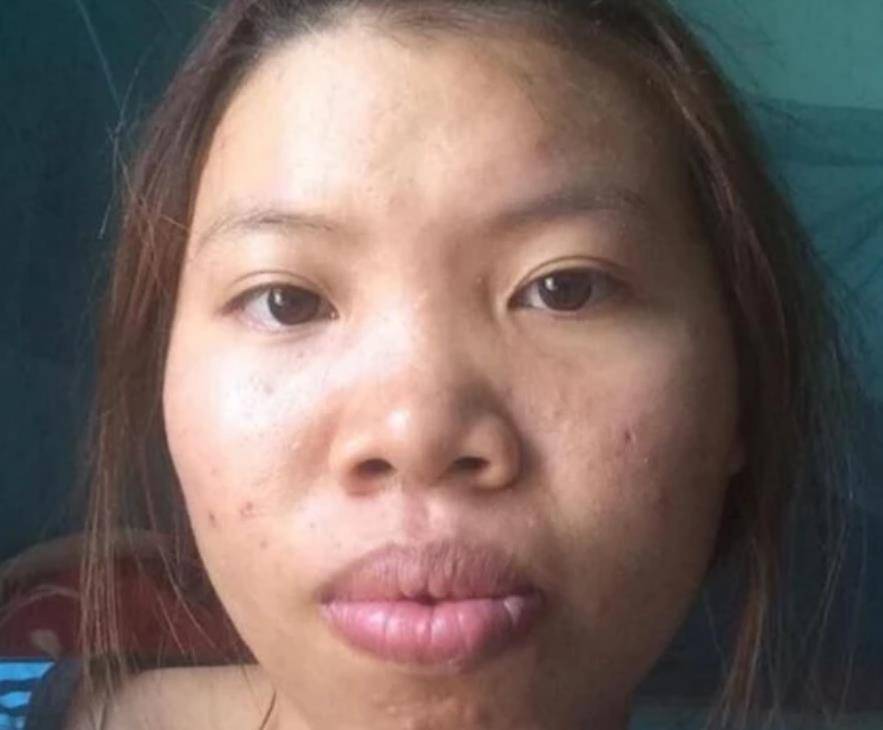 现实丑女整容后嫁给越南富二代，生下女儿被抛弃，网友看到结局：酸了