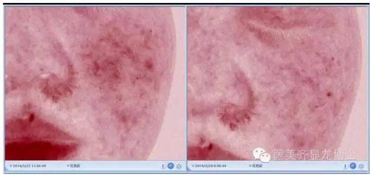 治疗齐显龙博士：敏感皮肤治疗和护理指南