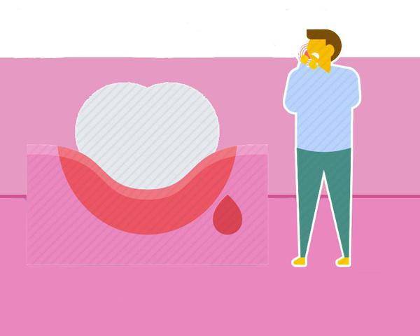 肝脏|肝脏好不好，一看便知！肝病患者，往往有4个共性，你不占才好！