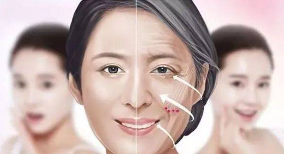小逸提升变美不可兼得？和射频提升相比，传统拉皮手术对面部有哪些影响？