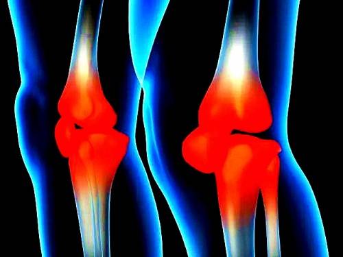 治疗|太乙堂董惠针药协同治疗风湿疼痛，应手辄效